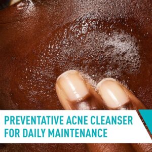 Acne Control Cleanser Acne Control Cleanser - Image 3