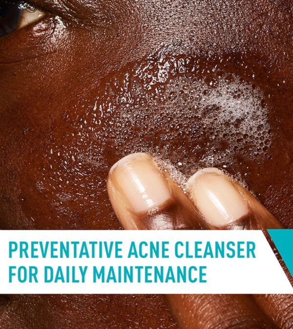 Acne Control Cleanser Acne Control Cleanser 2