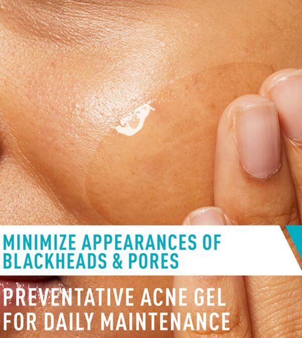 Acne Control Gel Acne Control Gel 73