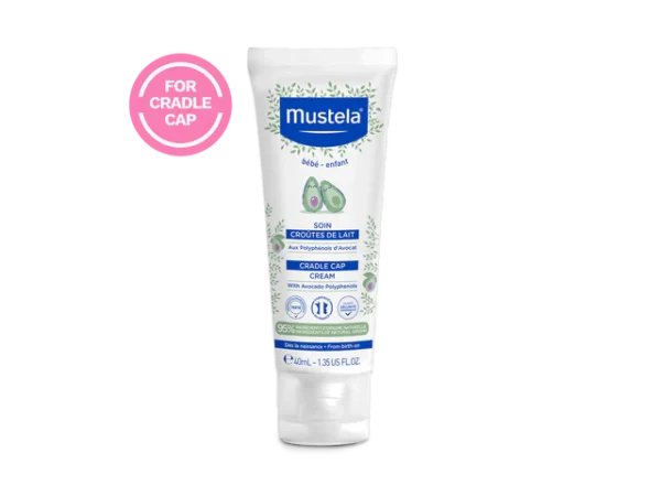 Cradle Cap Cream