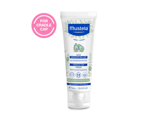 Cradle Cap Cream