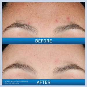 Resurfacing Retinol Serum - Image 3