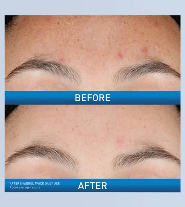 Resurfacing Retinol Serum 2